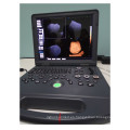 Ordenador portátil 3D y 4D Ultrasound Machine Price &amp; DAWEI DWC60 color Doppler
